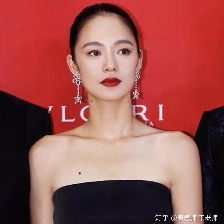 直角肩蝴蝶骨翘臀,你引以为豪的“性感体态”,实则是“火坑”