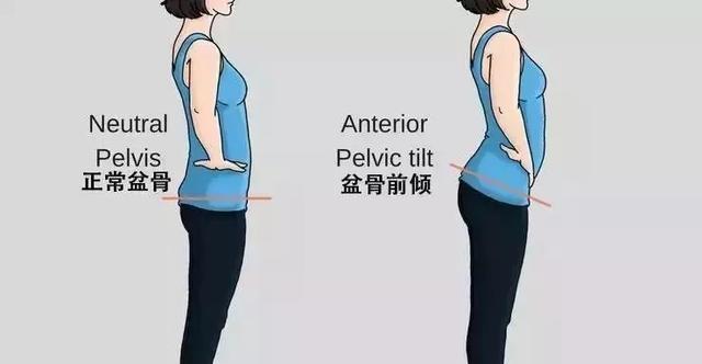 直角肩蝴蝶骨翘臀,你引以为豪的“性感体态”,实则是“火坑”