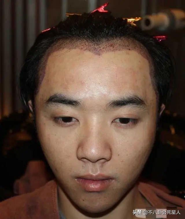 精修的是神颜,生图满脸痘,痘坑、黑眼圈、长斑,明星没那么美