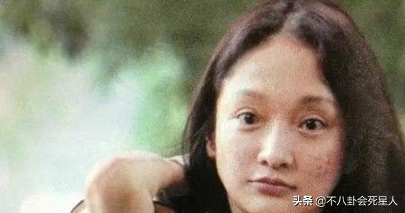 精修的是神颜,生图满脸痘,痘坑、黑眼圈、长斑,明星没那么美