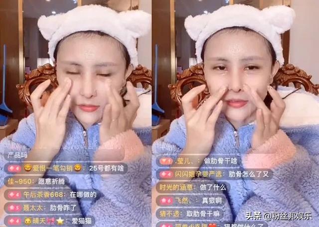 先变鬼再变美,猫妹妹整容取肋骨做鼻子,女人狠起来对自己都下手