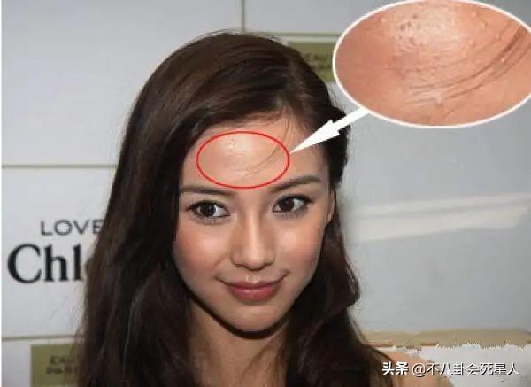 精修的是神颜,生图满脸痘,痘坑、黑眼圈、长斑,明星没那么美