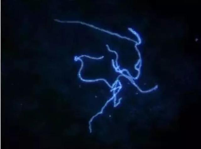 俩美女合租一间房得了一样的病:手腕上都长了“表”……