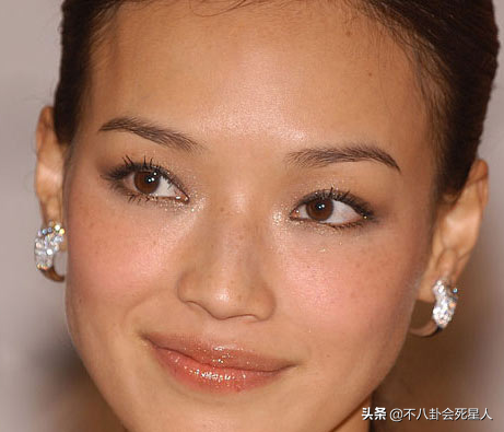 精修的是神颜,生图满脸痘,痘坑、黑眼圈、长斑,明星没那么美