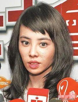 精修的是神颜,生图满脸痘,痘坑、黑眼圈、长斑,明星没那么美