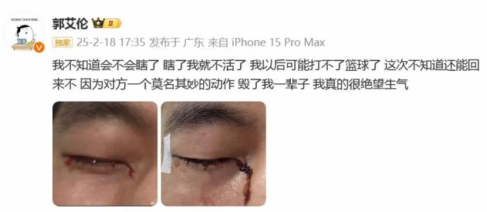 郭艾伦发声:这口气咽不下去