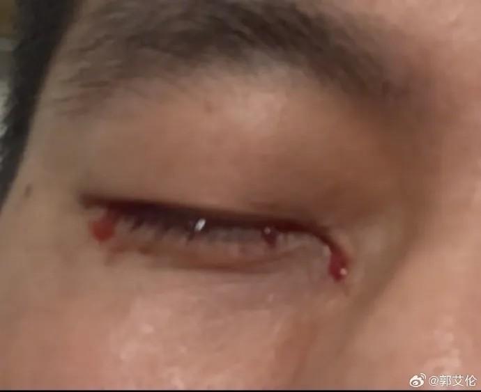 郭艾伦发声:这口气咽不下去