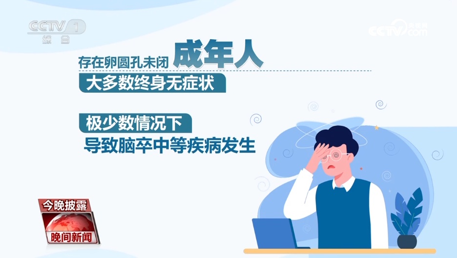 年轻不是“护身符”！警惕脑卒中，牢记“120口诀”