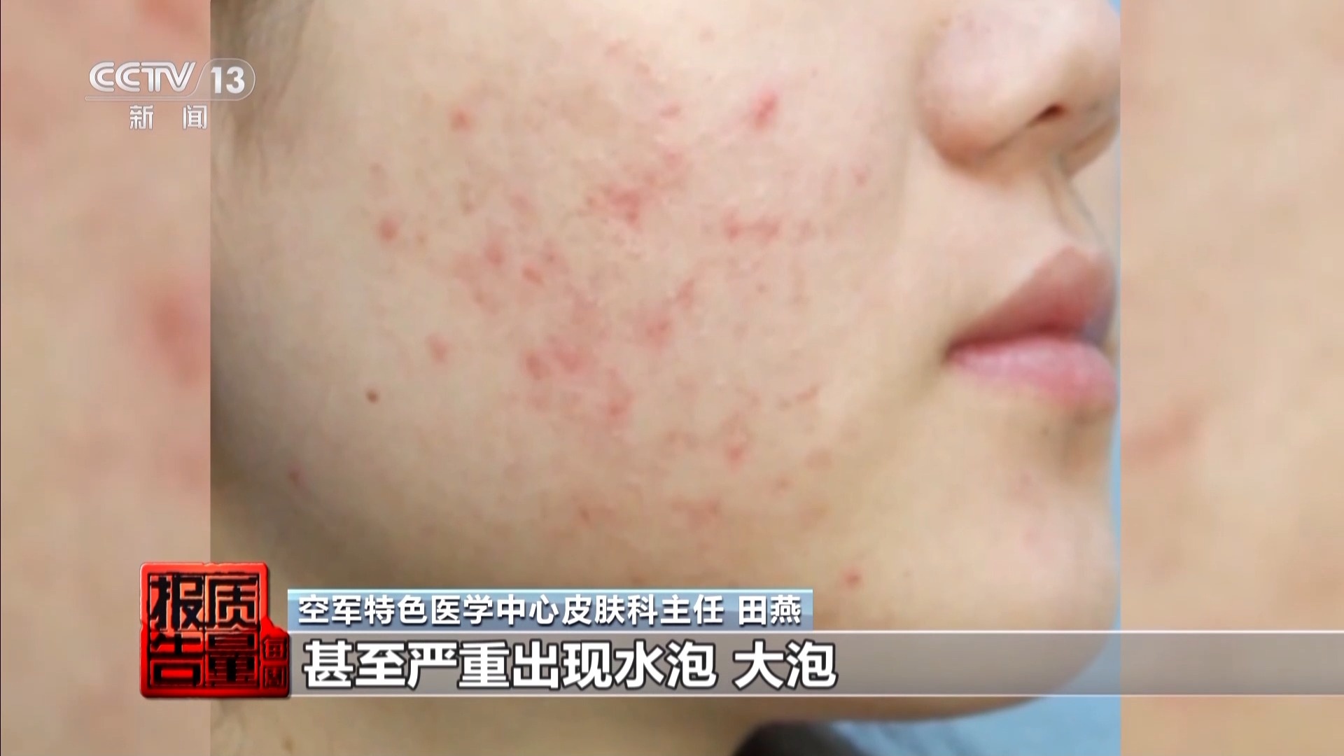 揭开防晒化妆品的“迷雾” “防护”还是“防晒”?