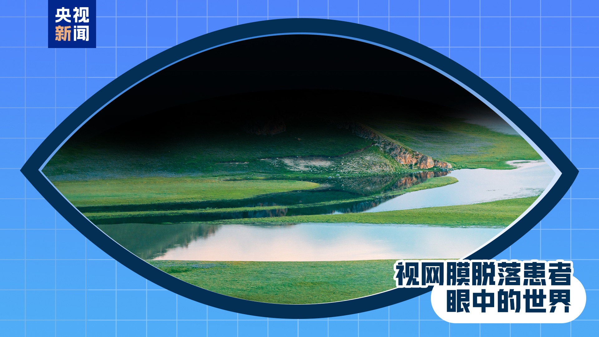 全国爱眼日丨出现这些症状 是眼睛在报警!