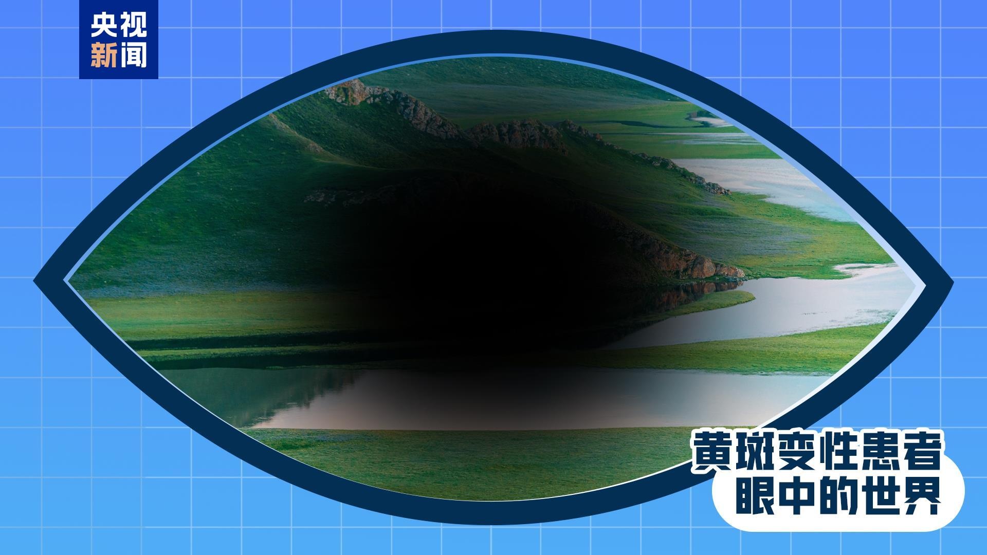 全国爱眼日丨出现这些症状 是眼睛在报警!