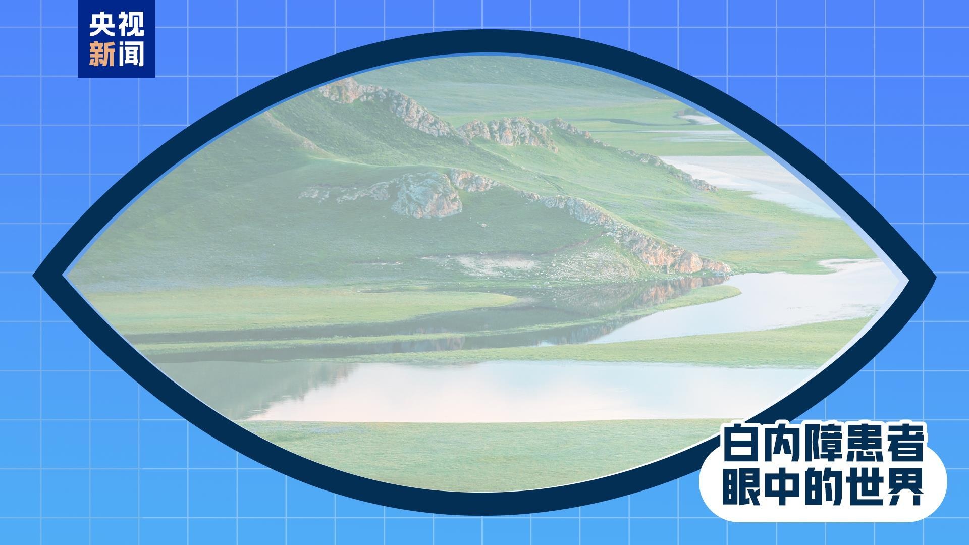 全国爱眼日丨出现这些症状 是眼睛在报警!